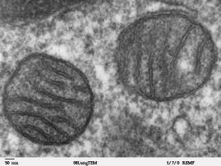 mitochondria.jpg