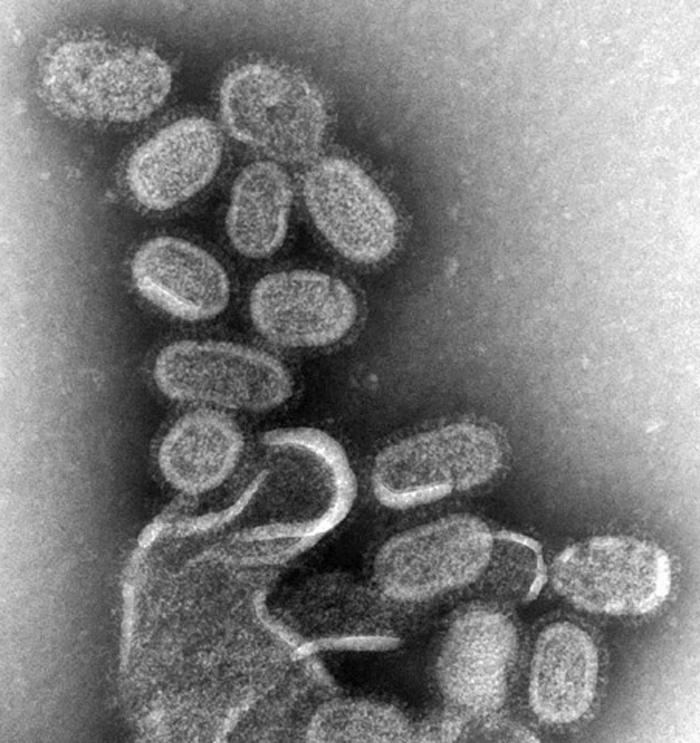 influenzaVirus.jpg