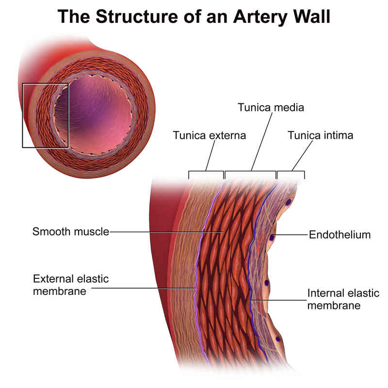 artery.jpg