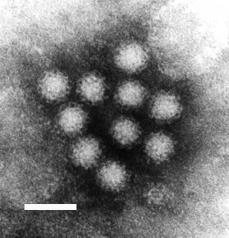 norovirus.jpg