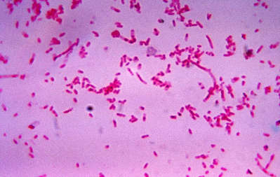 fusoBacterium.jpg