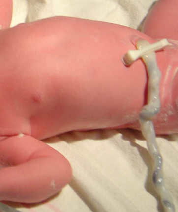 umbilicalCord.jpg