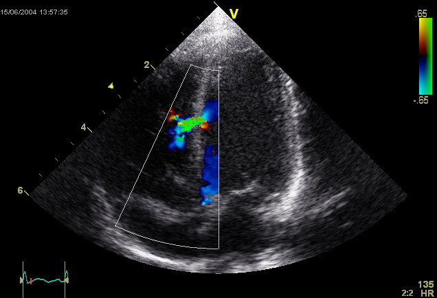 echocardiogram.jpg