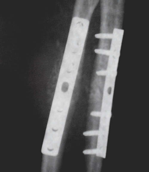 implant1.jpg